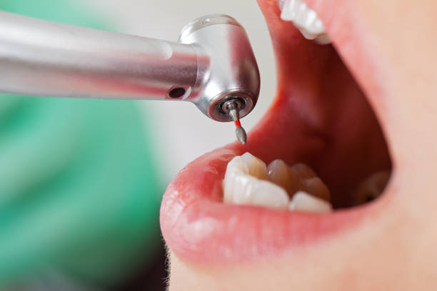 Best Emergency Cosmetic Dentistry in Springhill, LA